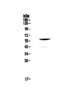 Cannabinoid Receptor I/CNR1 Rabbit Polyclonal Antibody