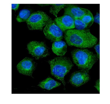 VAPB Rabbit Polyclonal Antibody