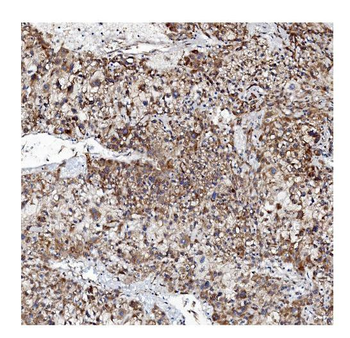 VAPB Rabbit Polyclonal Antibody