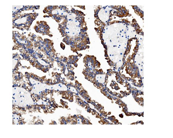 VAPB Rabbit Polyclonal Antibody
