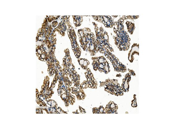 VAPB Rabbit Polyclonal Antibody