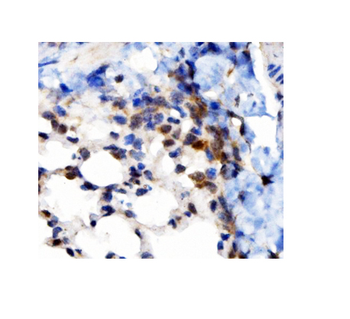VAPB Rabbit Polyclonal Antibody