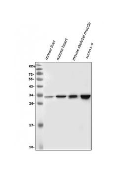 VAPB Rabbit Polyclonal Antibody