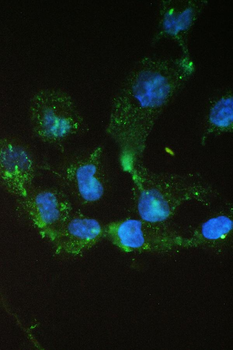 epithelial Sodium Channel alpha/SCNN1A Rabbit Polyclonal Antibody