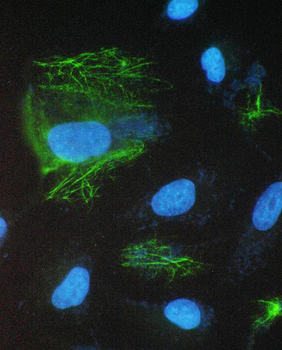 epithelial Sodium Channel alpha/SCNN1A Rabbit Polyclonal Antibody