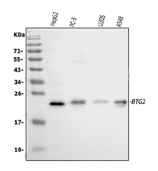 BTG2 Rabbit Polyclonal Antibody