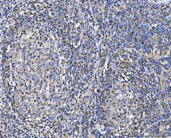 Glutathione Reductase/GSR Rabbit Polyclonal Antibody