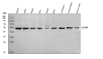 Glutathione Reductase/GSR Rabbit Polyclonal Antibody