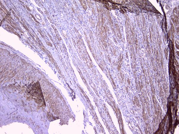 PBP/PEBP1 Rabbit Polyclonal Antibody