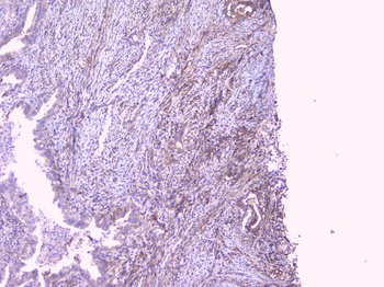 PBP/PEBP1 Rabbit Polyclonal Antibody