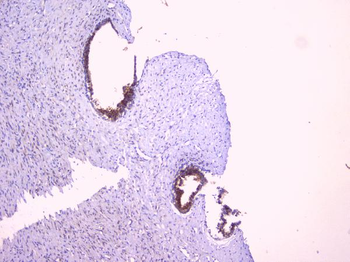 PBP/PEBP1 Rabbit Polyclonal Antibody