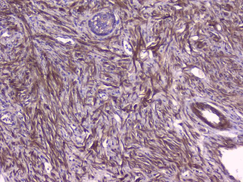 PBP/PEBP1 Rabbit Polyclonal Antibody