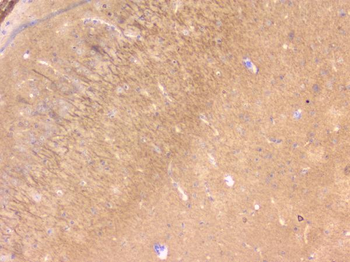 PBP/PEBP1 Rabbit Polyclonal Antibody
