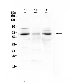 CCKBR Antibody
