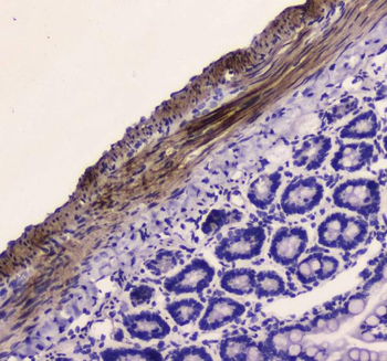 Myosin light chain kinase/MYLK Rabbit Polyclonal Antibody