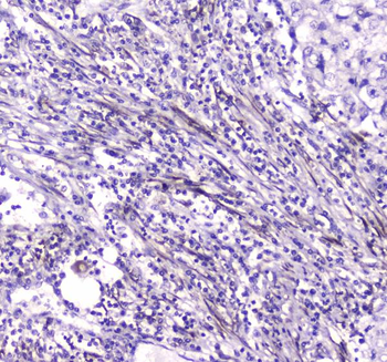 Liver Carboxylesterase 1/CES1 Rabbit Polyclonal Antibody