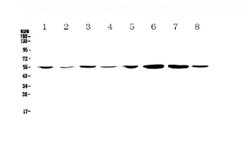 CCR3 Rabbit Polyclonal Antibody