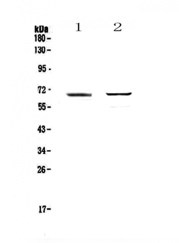 RUNX1T1/ETO Rabbit Polyclonal Antibody