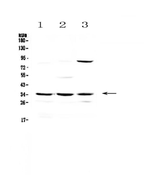 Bikunin/AMBP Rabbit Polyclonal Antibody