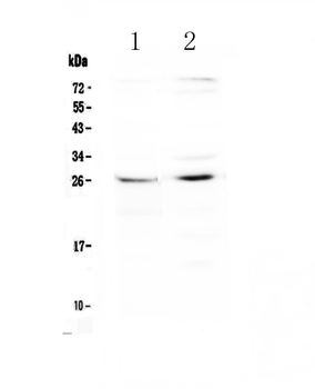 SLC31A1/CTR1 Rabbit Polyclonal Antibody