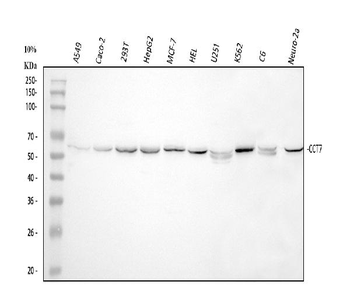 TCP1 eta/CCT7 Rabbit Polyclonal Antibody