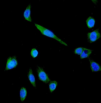 P Glycoprotein/ABCB1 Rabbit Polyclonal Antibody