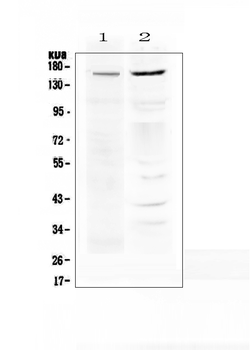 P Glycoprotein/ABCB1 Rabbit Polyclonal Antibody