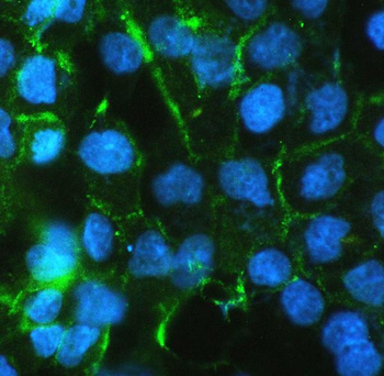 beta Catenin CTNNB1 Mouse Monoclonal Antibody