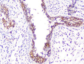 beta Catenin CTNNB1 Mouse Monoclonal Antibody