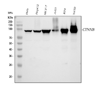 beta Catenin CTNNB1 Mouse Monoclonal Antibody