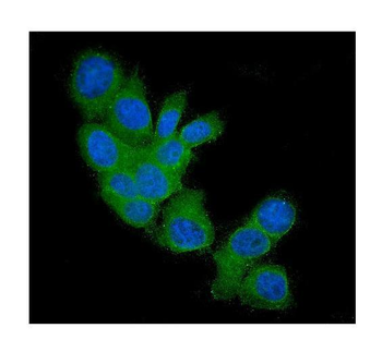 FHIT Mouse Monoclonal Antibody