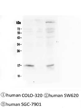 FHIT Mouse Monoclonal Antibody