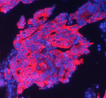 Cytokeratin 19 KRT19 Antibody (monoclonal, 3D4)