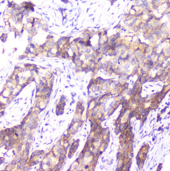 SMN1/2 Mouse Monoclonal Antibody