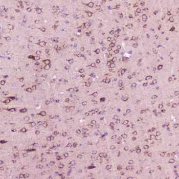 Calcitonin/Calca Rabbit Polyclonal Antibody