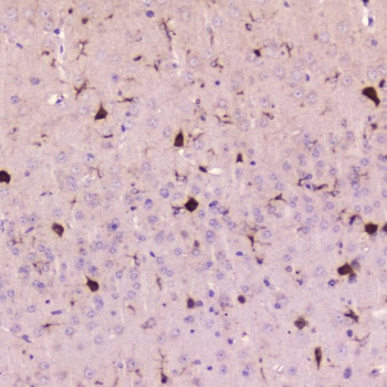 Cystatin C/CST3 Rabbit Polyclonal Antibody