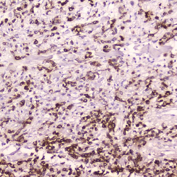 Cathepsin E/CTSE Rabbit Polyclonal Antibody