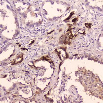 Cathepsin E/CTSE Rabbit Polyclonal Antibody