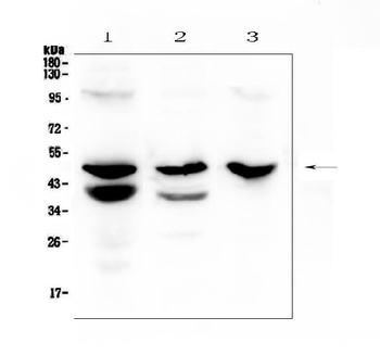 Cathepsin E/CTSE Rabbit Polyclonal Antibody
