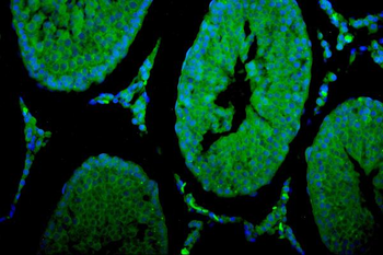 Cytochrome P450 17A1/Cyp17a1 Rabbit Polyclonal Antibody