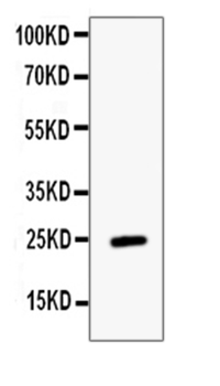 ESM1 Rabbit Polyclonal Antibody