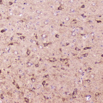 IGFBP2 Rabbit Polyclonal Antibody