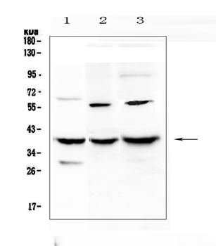 IGFBP2 Rabbit Polyclonal Antibody