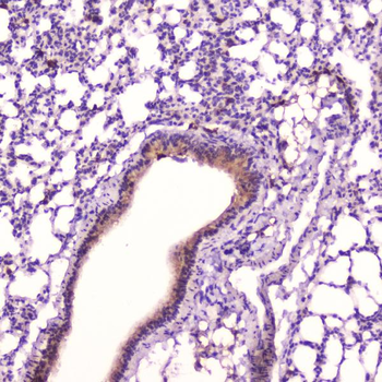 Leptin Rabbit Polyclonal Antibody