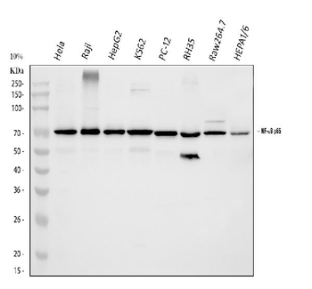 NF-kB p65/RELA/NF Rabbit Polyclonal Antibody