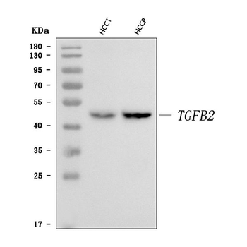 TGF beta 2/TGFB2 Rabbit Polyclonal Antibody