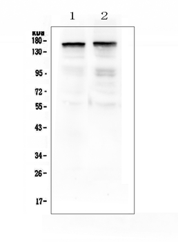Thrombospondin 2/THBS2 Rabbit Polyclonal Antibody