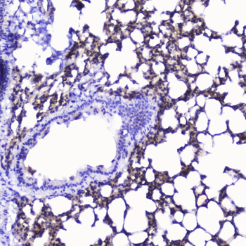 Talin 1/TLN1 Rabbit Polyclonal Antibody