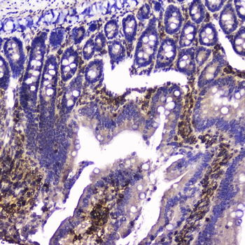 Talin 1/TLN1 Rabbit Polyclonal Antibody