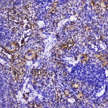 Talin 1/TLN1 Rabbit Polyclonal Antibody